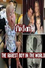 Watch Aidan The Rarest Boy In The World Movie4k