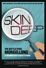 Watch Skin Deep: The Battle Over Morgellons Movie4k