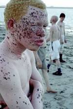 Watch Albino United Movie4k