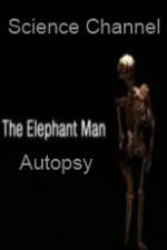 Watch Science Channel Elephant Man Autopsy Movie4k