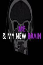 Watch Me & My New Brain Movie4k