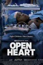 Watch Open Heart Movie4k