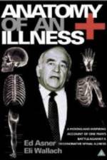 Watch Anatomy of an Illness Movie4k