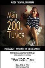 Watch The Man With The 200lb Tumor Movie4k