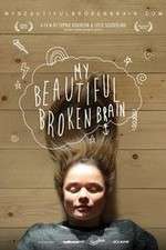 Watch My Beautiful Broken Brain Movie4k