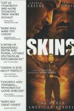 Watch Skins Movie4k