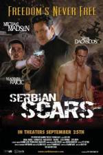 Watch Serbian Scars Movie4k