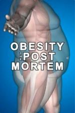 Watch Obesity: The Post Mortem Movie4k