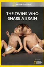 Watch National Geographic The Twins Who Share A Brain Movie4k