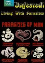 Watch Infested! Living with Parasites Movie4k