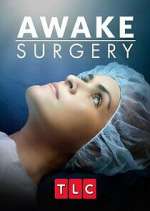 Watch Awake Surgery Movie4k