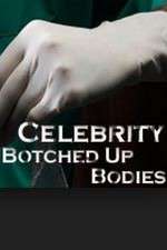 Watch Celebrity Botched Up Bodies Movie4k